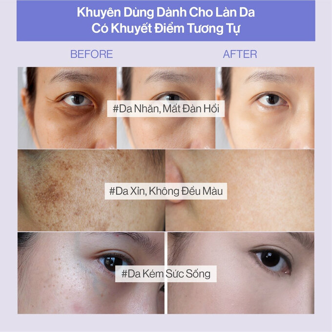 Những Lưu Ý Khi Uống Collagen Gilaa