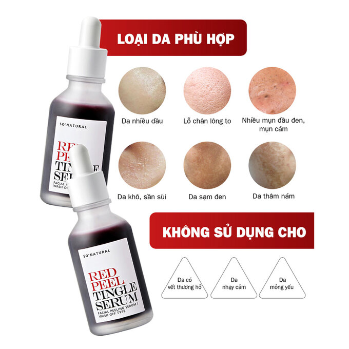 Serum So'Natural Tái Tạo Da Sinh Học, Mờ Thâm Sáng Da 35ml