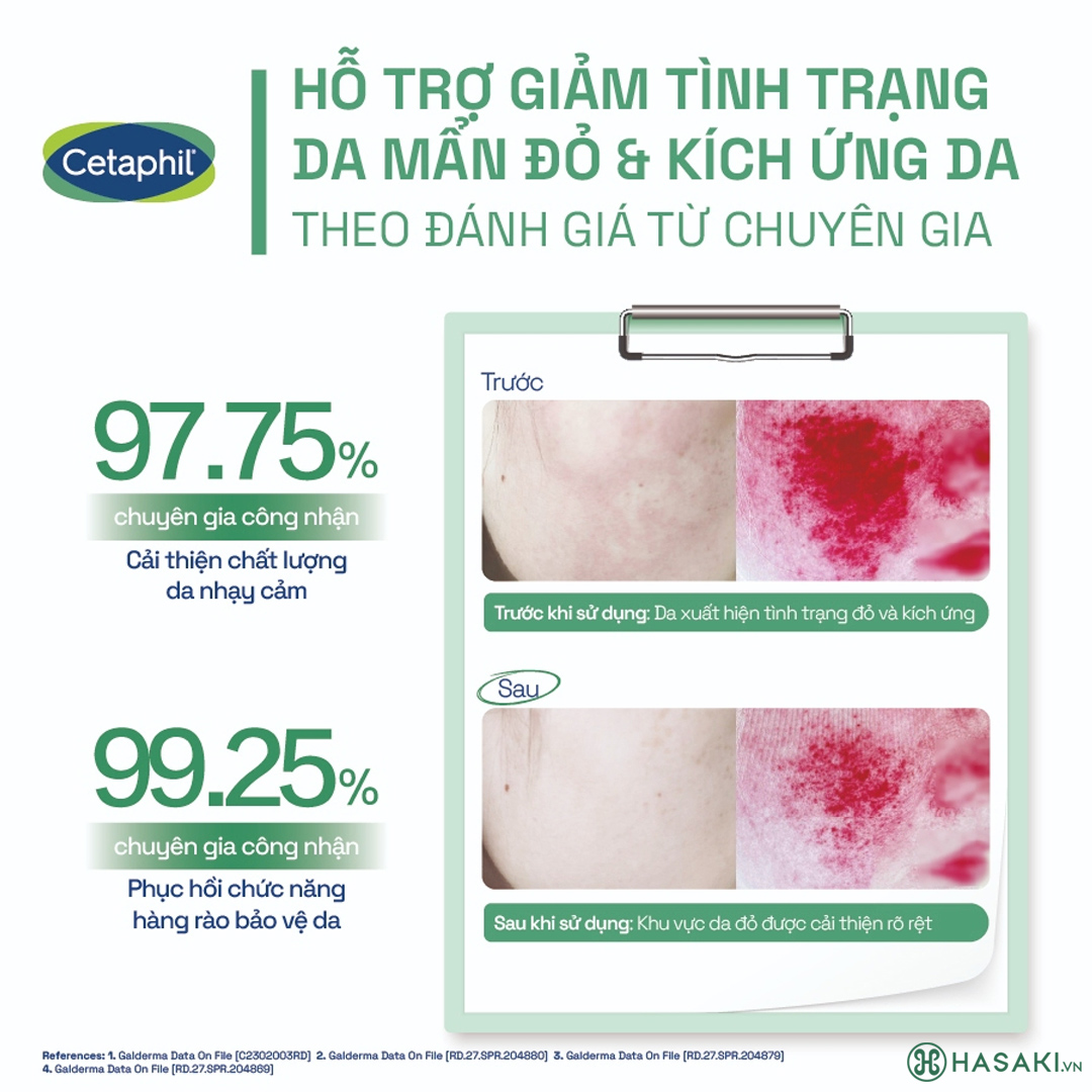 Kem Dưỡng Ẩm Cetaphil Làm Dịu Và Phục Hồi Chuyên Sâu 45ml đã có mặt tại Hasaki 