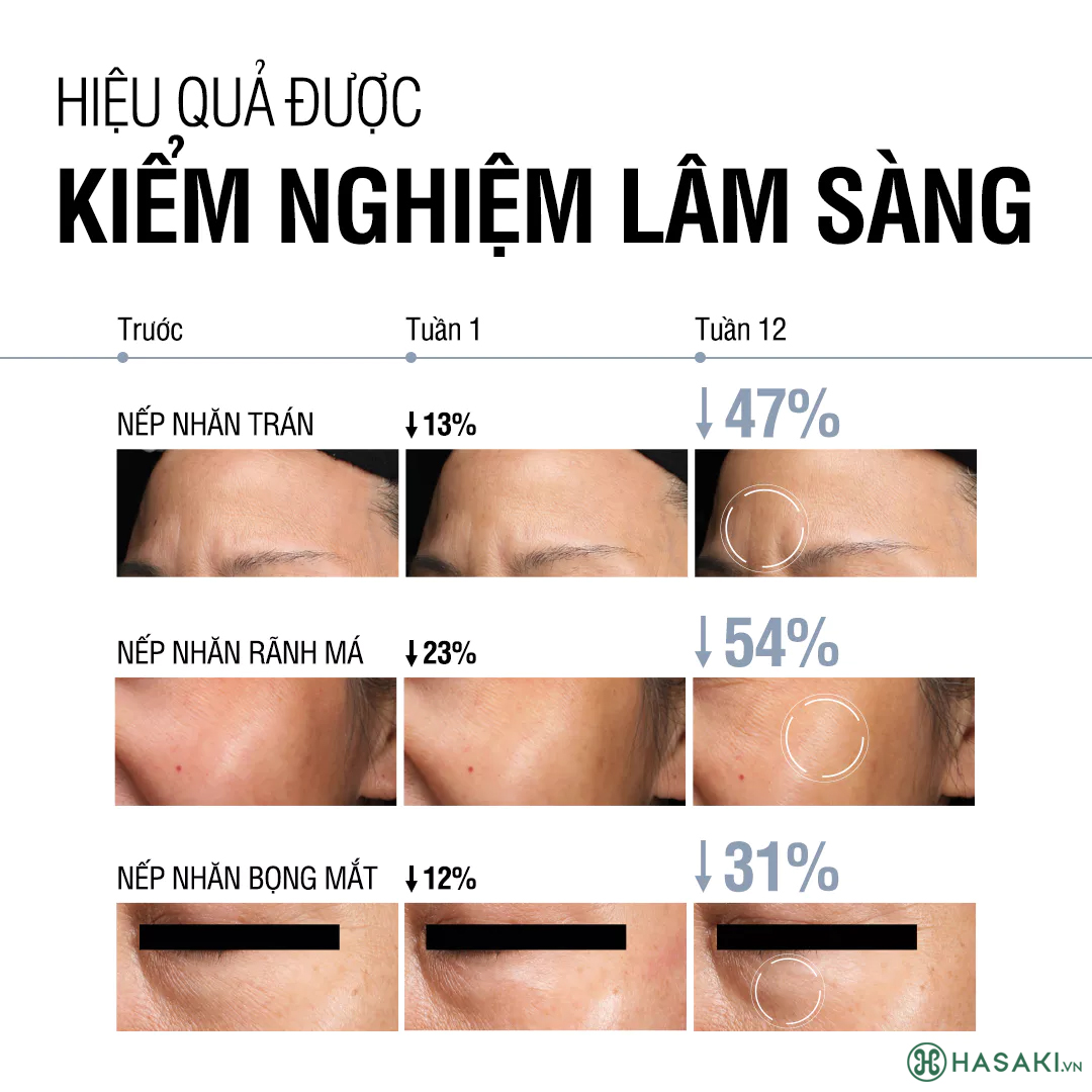 Kem Dưỡng Neutrogena Visible Repair Regenerating Cream 50g đã có mặt tại Hasaki