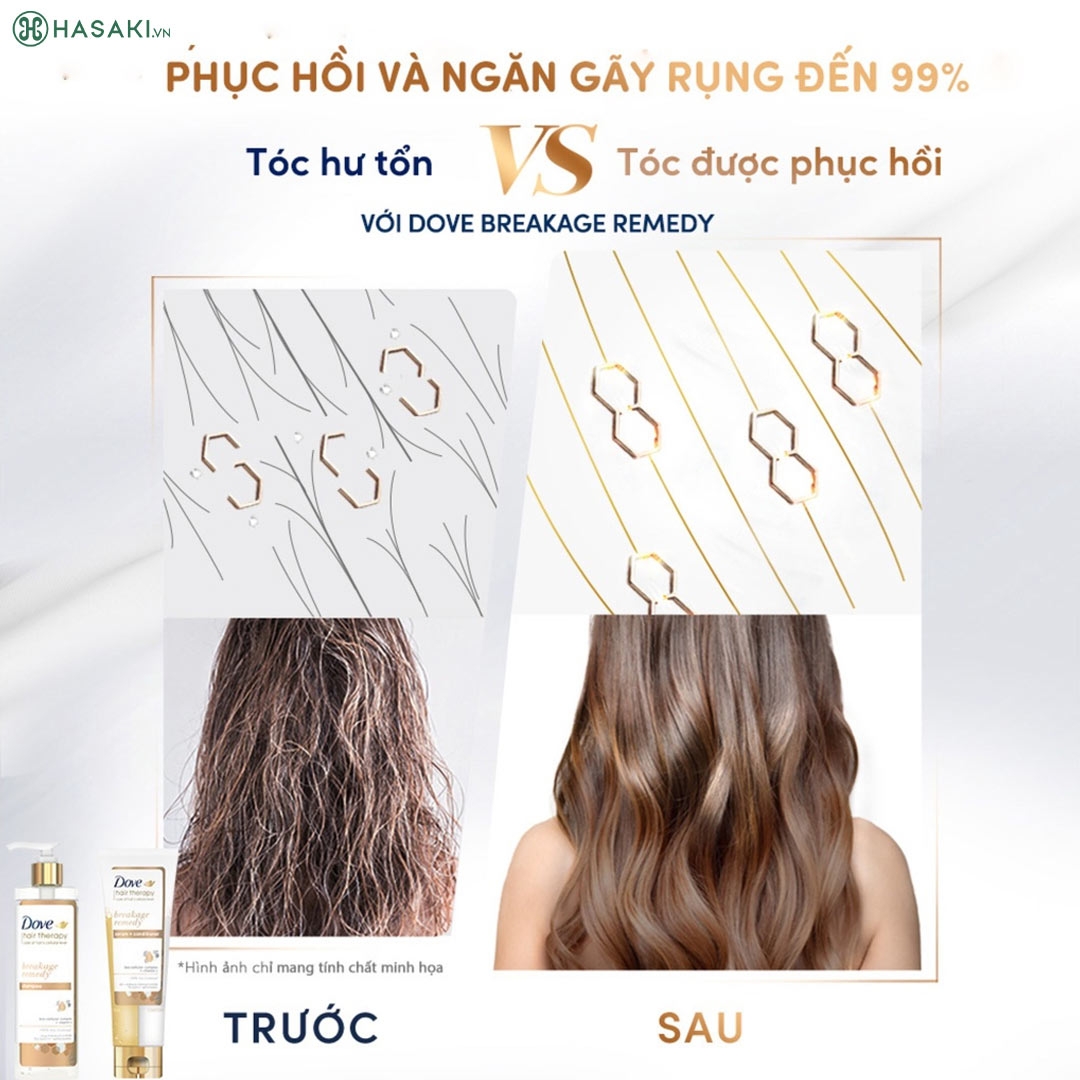 Dầu Gội Dove Hair Therapy Breakage Remedy Shampoo Phục Hồi & Ngăn Gãy Rụng 380ml