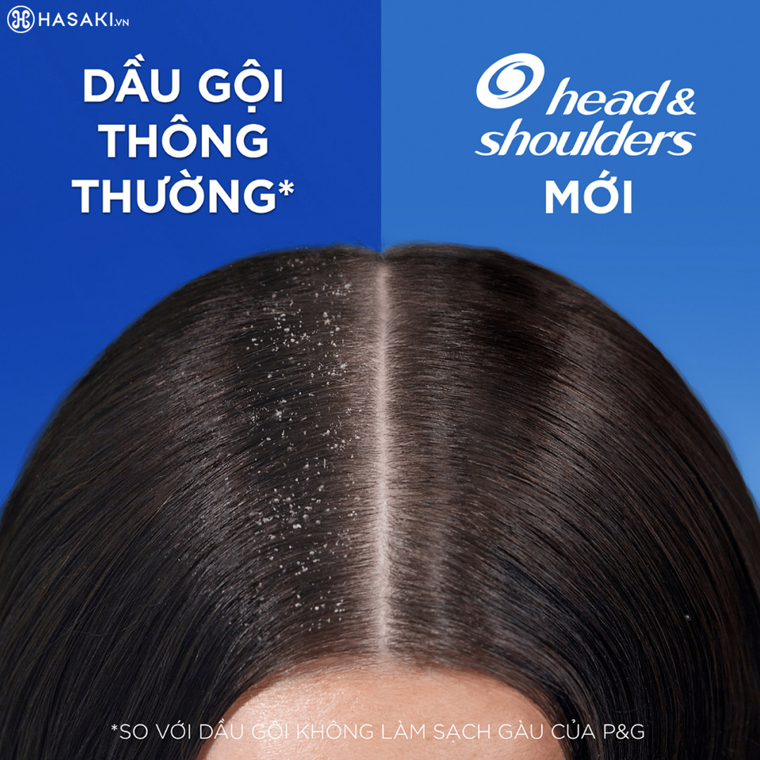 Mua dòng sản phẩm Dầu Gội Head & Shoulders Làm Sạch Gàu chính hãng tại Hasaki.