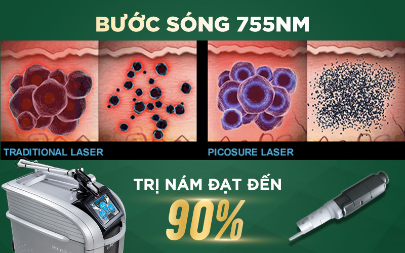 Điều trị nám công nghệ Laser Pico Pro hiệu quả gấp 3 lần