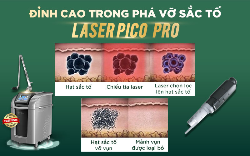 Đỉnh cao của Laser Pico Pro trong điều trị tăng sắc tố