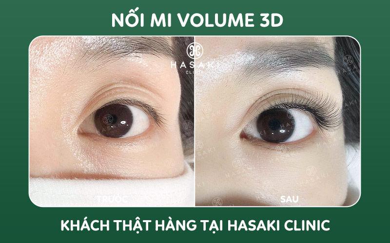 Khách hàng thực tế nối mi volume 3D tại Hasaki Clinic