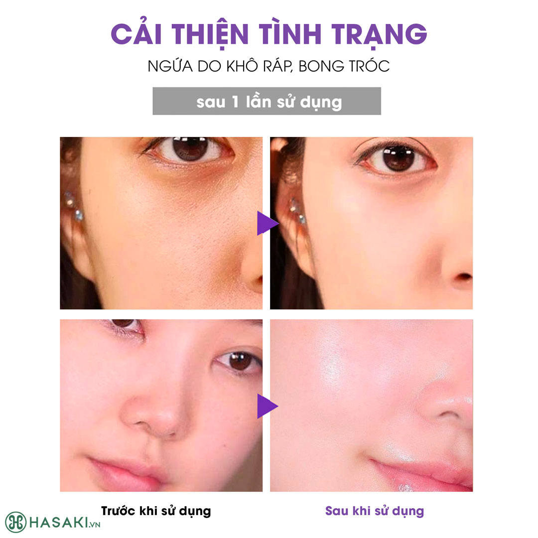 Mặt Nạ Sur.Medic+ Super Calm Repairing Mask 